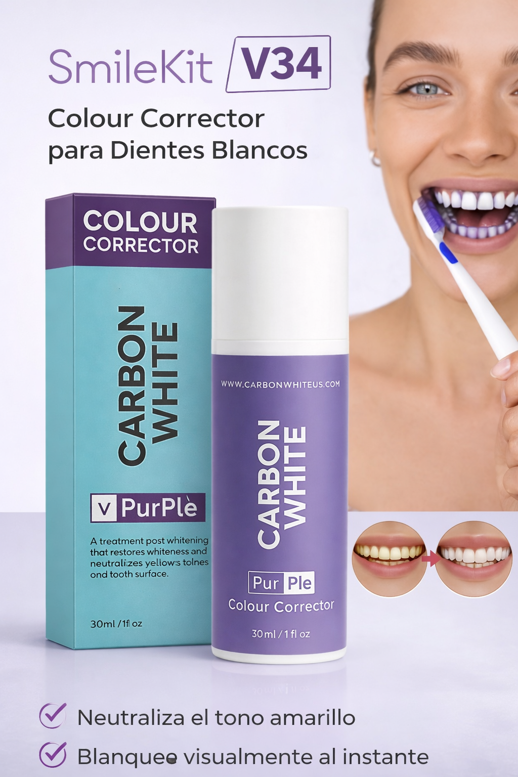 SmileKit V34 – Corrector de Color para Dientes Blancos
